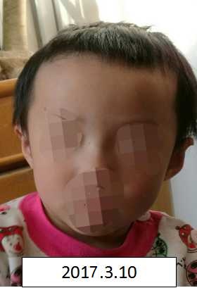 免费阴茎插阴道视频